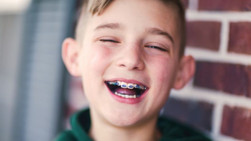 A young boy laughs, showing off his blue braces.
